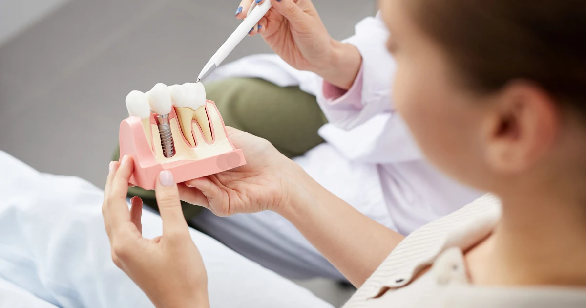 Where to Get the Best Metal Free Dental Implants